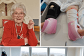 Gran died after suffering fall when medics tried to lift her with a towel