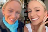 I think I just found the quickest and easiest way to whiten my teeth for summer