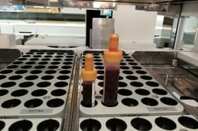Blood testing services in East Lancashire have faced severe disruption since June - and the situation has just got worse