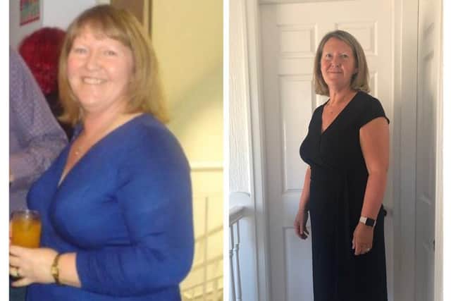 Shirley Hanson's 'before' and 'after' photos