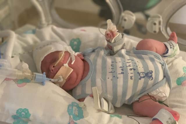 Tiny Archie Edwards, who was born 15 weeks early, beat off sepsis and covid