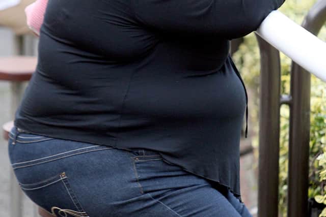 More people admitted to hospital due to obesity in Lancashire