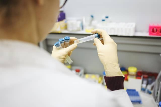 Scammers are offering PCR tests for the Omicron variant, which was named days ago (Photo by Polina Tankilevitch)