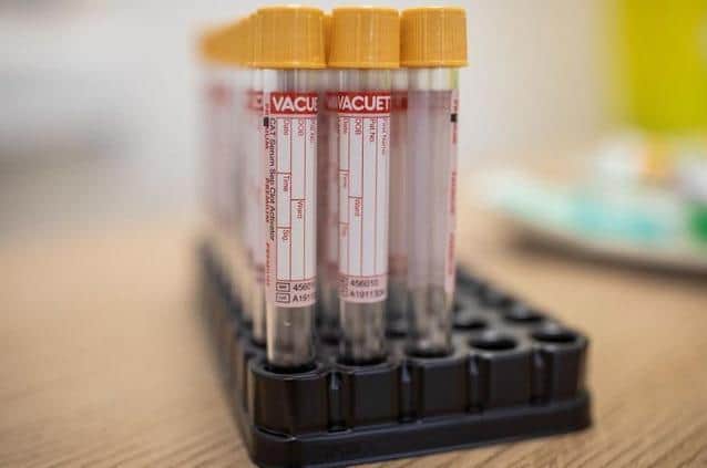 If you want to get tested, you need a general coronavirus test, details are available from the NHS website. Photo Getty