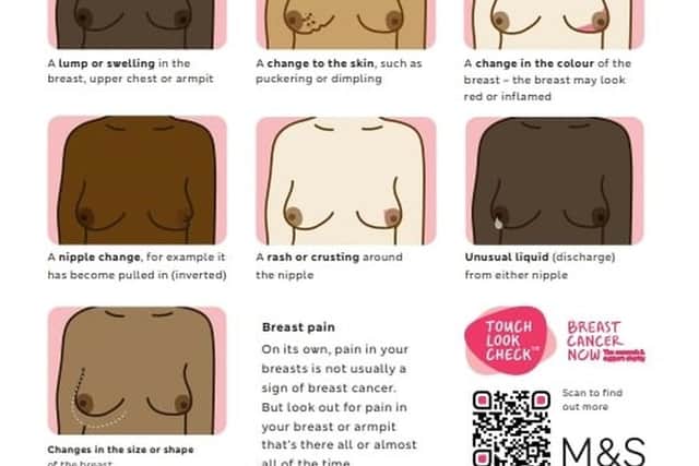 Women are being encouraged to regularly check for some of the signs and symptoms of breast cancer, which are pictured here.