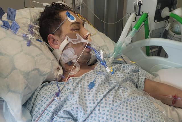 Oliver had to be air lifted to Leeds General Infirmary, where he spent four weeks in a coma while doctors saved his life