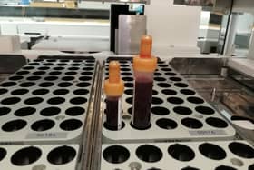Currently, all blood tests and other pathology samples are processed at local hospital sites across Lancashire