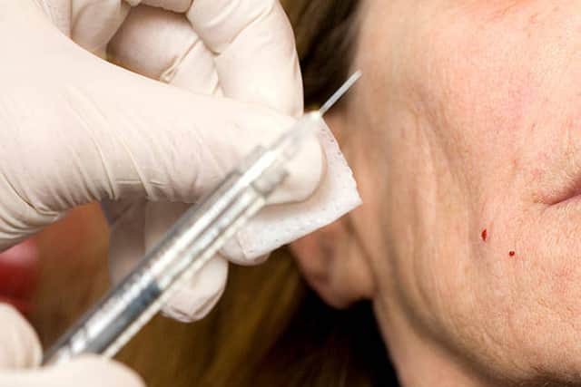 At least 1,309 cosmetic fillers were botched in 2019, according to charity Save Face.