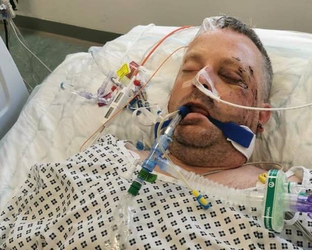Paul Harvey nearly died died when he was thrown off his bike