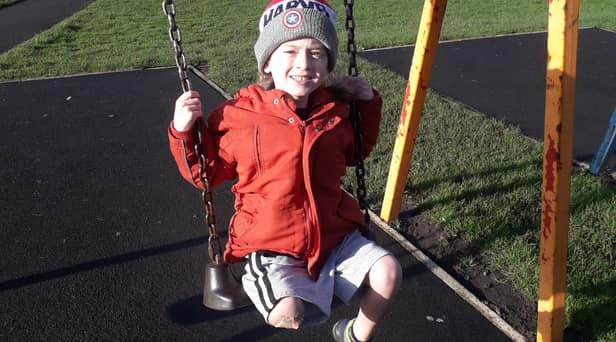 Clitheroe boy Jake Bond has had his leg amputated after battling Strep A.