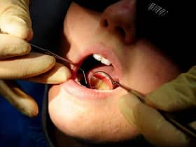 The number of people seeing an NHS dentist in Lancashire in the past two years has fallen sharply - from just under two thirds to just over a third