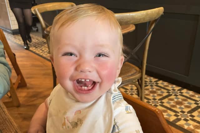 Jonah Holt, who turns one this month, has been diagnosed with a rare condition called Tuberous Sclerosis Complex (TSC)
