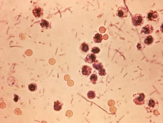 Shigella bacteria