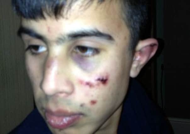 Jewel Ahmed who was attacked with a knuckle duster as he walked home from a friend's house (s)