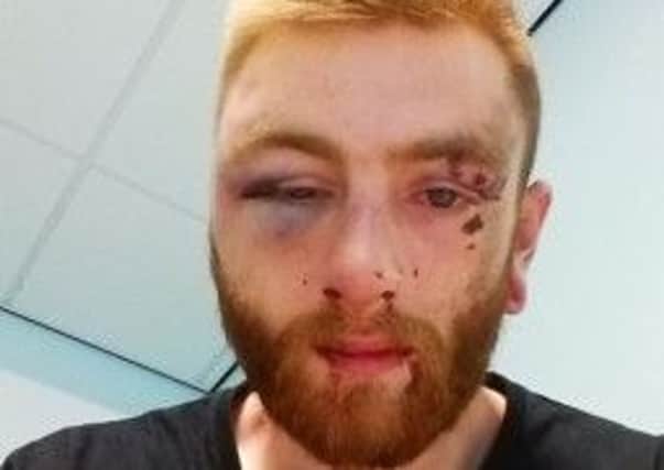 Sam Kane who was attacked by eight or nine men at the weekend (s)