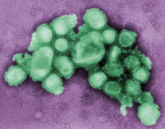 EXPOSURE: The H1N1 virus under the microscope