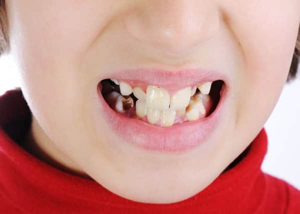 The cost of children's bad teeth is rising