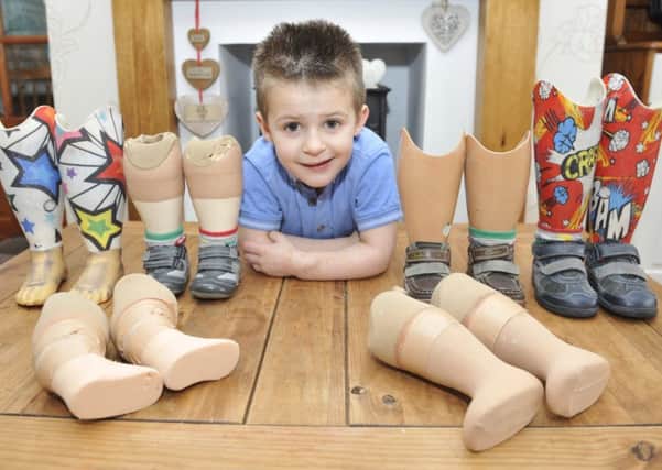 Louie Jenkins, from Colne, is facing further surgery to his legs which he lost after contracting meningitis as a baby