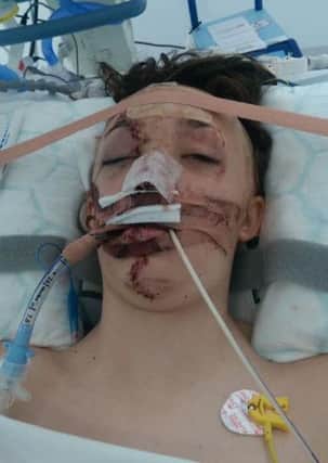 Georgia Addy, 15, from Burscough in critical condition in Alder Hey hopsital after a collision with a van.