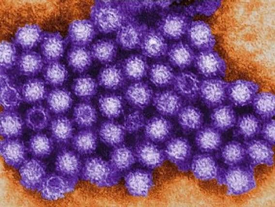 Experts have issued advice on how to stop the spread of Norovirus