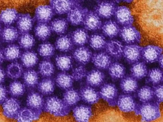 Do you know what to do if you have norovirus?