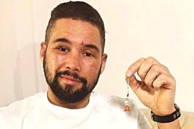 Boxer David Bellew with his tiny angel