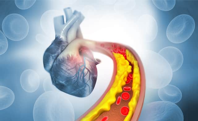 Cholesterol plays an important role in how your body functions (Photo: Shutterstock)